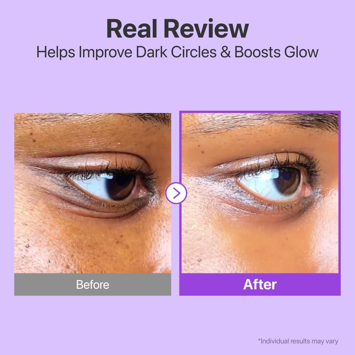 Volumetox Eye Cream 100 gm yzatrg-dh