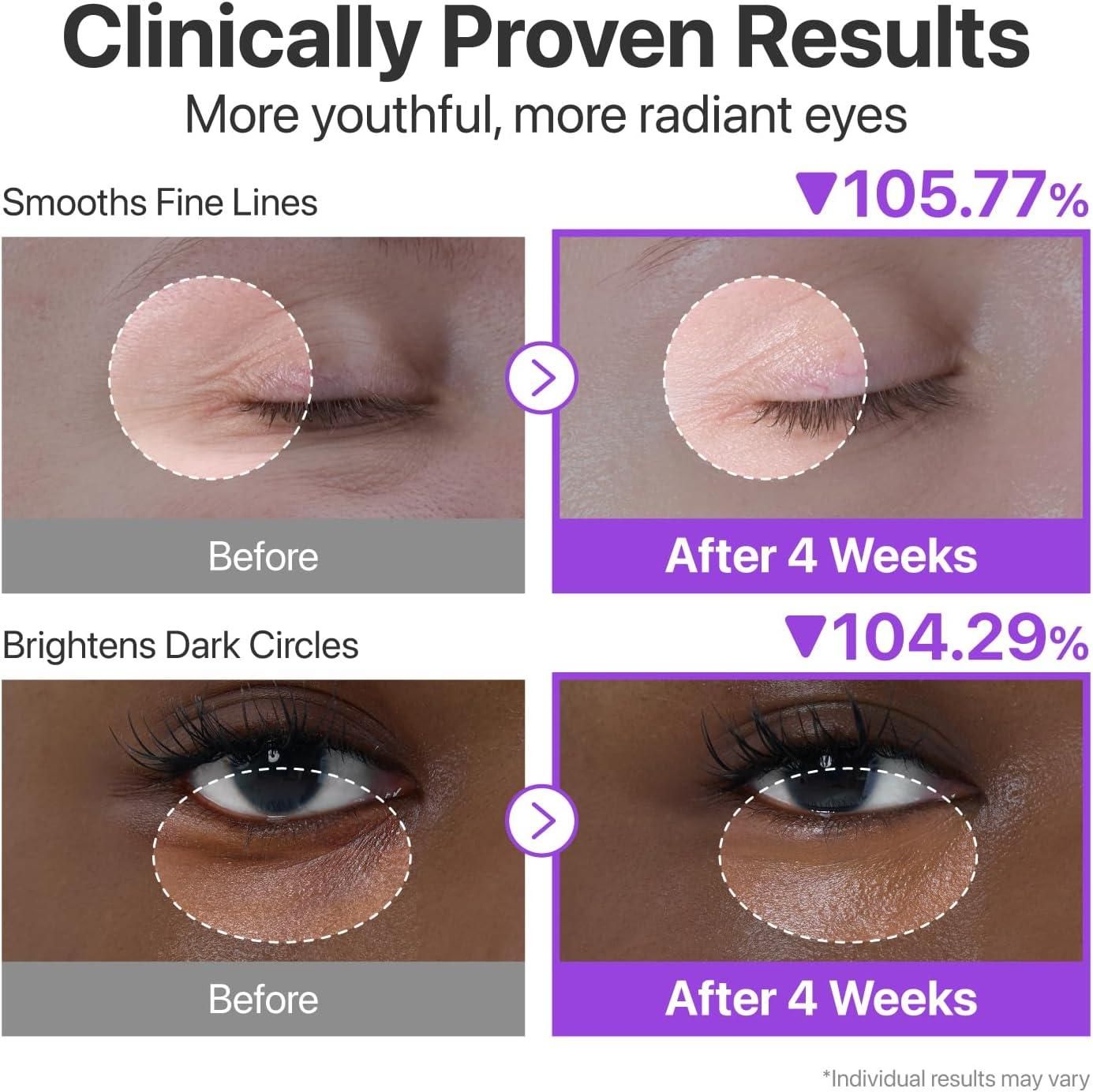 Volumetox Eye Cream 100 gm yzatrg-dh